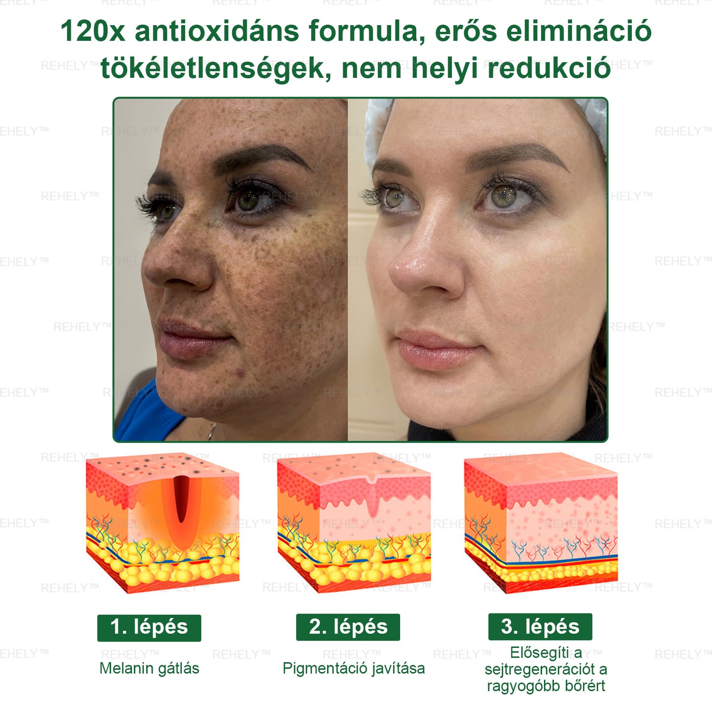 ☀️REHELY™ Természetes Bőrregeneráló Kenőcs | Tisztán vegán, állatkísérlet-mentes