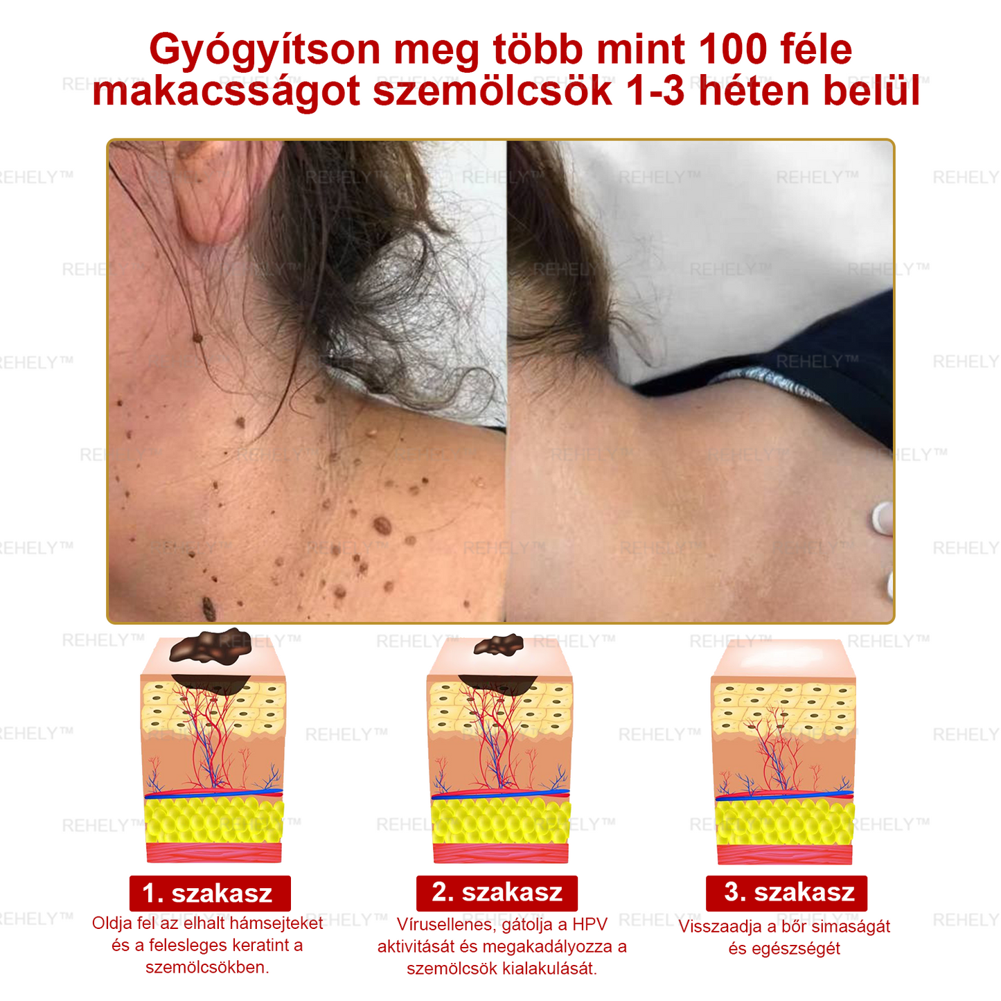 🌺REHELY™ Sejtregeneráló Hidratáló Krém