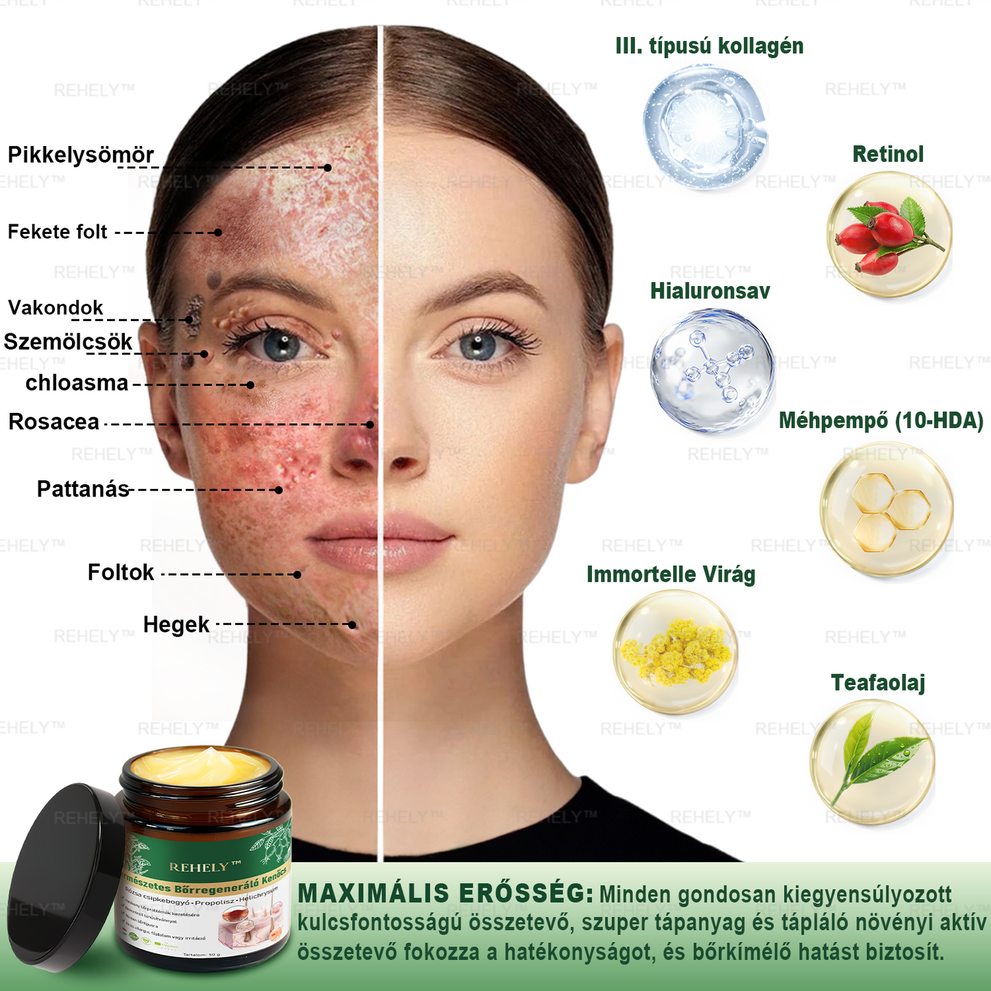 ☀️REHELY™ Természetes Bőrregeneráló Kenőcs | Tisztán vegán, állatkísérlet-mentes