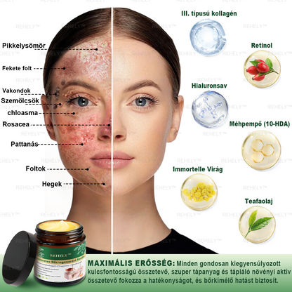 ☀️REHELY™ Természetes Bőrregeneráló Kenőcs | Tisztán vegán, állatkísérlet-mentes