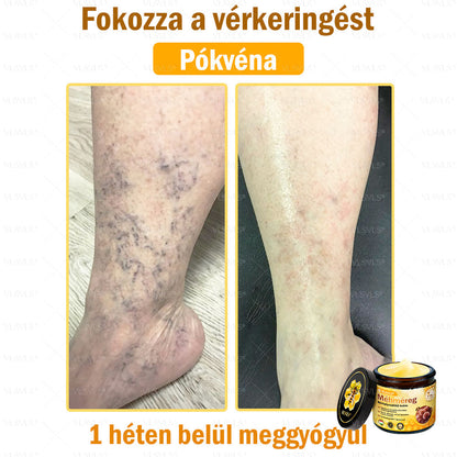 ✨✨✨💪VLSVLS® Méhméreg Bőrhelyreállító Krém (👨‍⚕‍CE jóváhagyott)👍✅