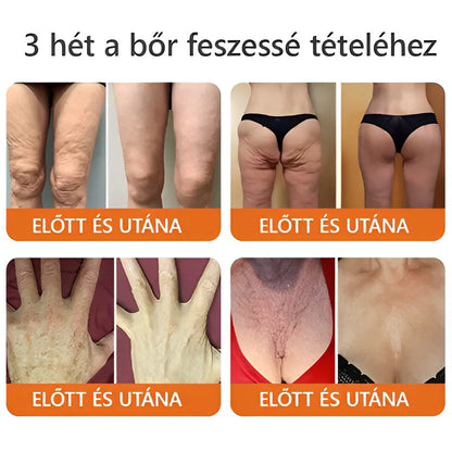 💛 ZödVita® Méhméreg Bőr Helyreállító Krém 🔥 Magyar fejlesztés, magyarországi gyártás és szállítás