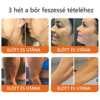ZödVita® Méhméreg Bőr Helyreállító Krém |  Magyar fejlesztés, magyarországi gyártás és szállítás