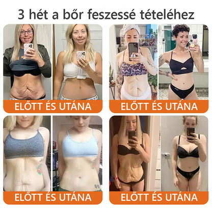 🐝🐝 ZödVita® Méhméreg Bőr Helyreállító Krém (👨‍⚕‍CE jóváhagyott)👍✅