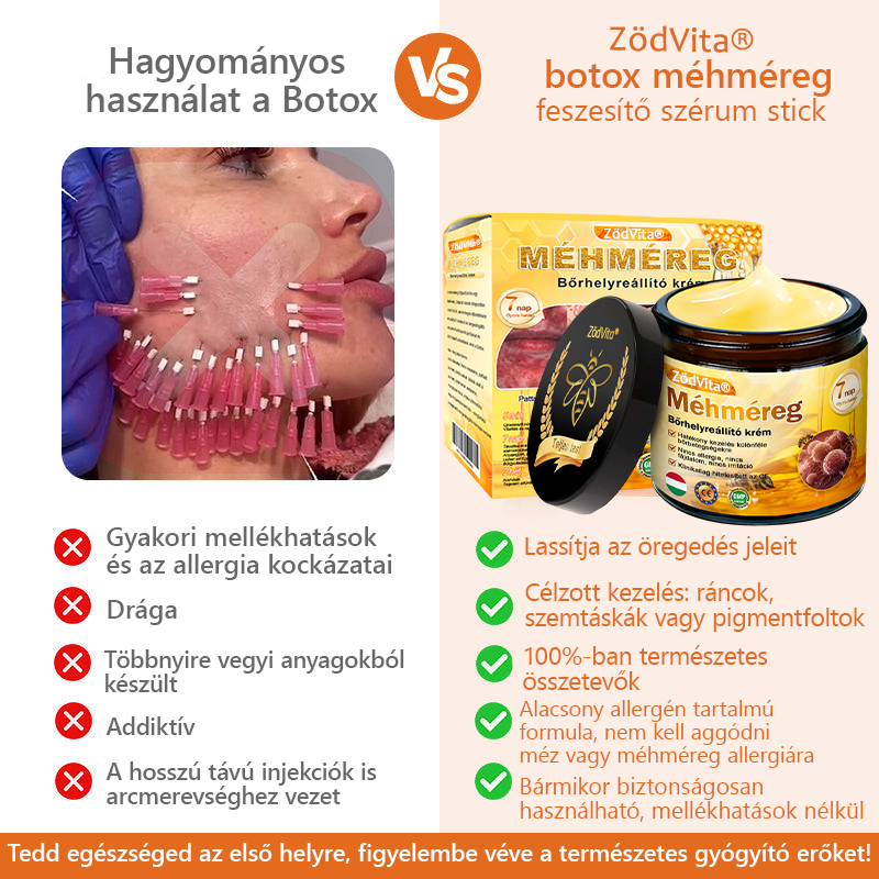🐝🐝 ZödVita® Méhméreg Bőr Helyreállító Krém (👨‍⚕‍CE jóváhagyott)👍✅