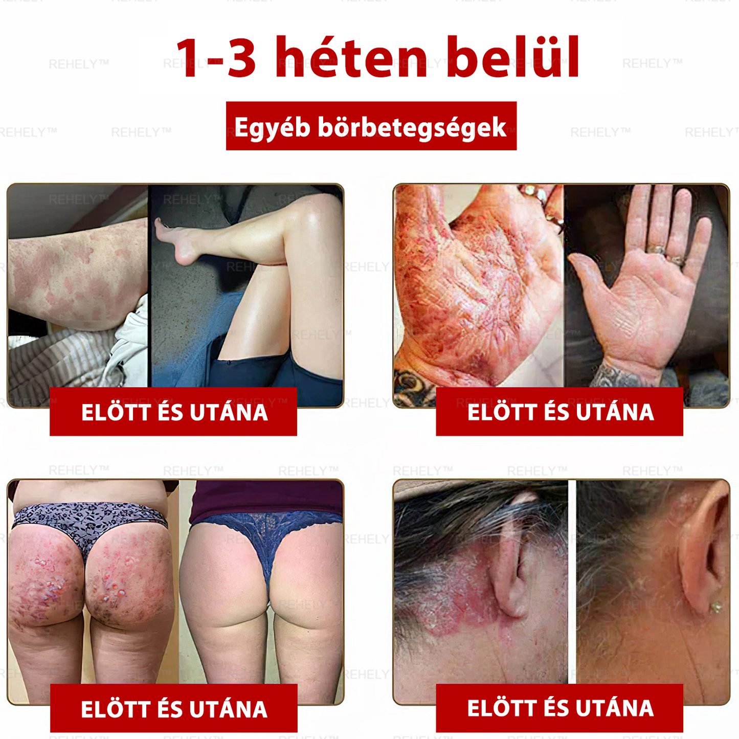 🌺REHELY™ Sejtregeneráló Hidratáló Krém