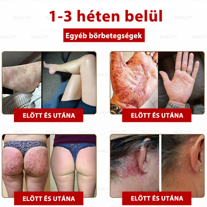 🌺REHELY™ Sejtregeneráló Hidratáló Krém