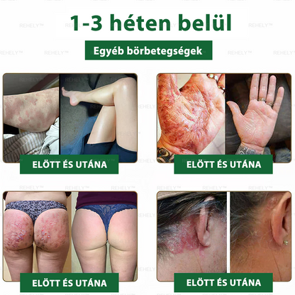 ☀️REHELY™ Természetes Bőrregeneráló Kenőcs | Tisztán vegán, állatkísérlet-mentes