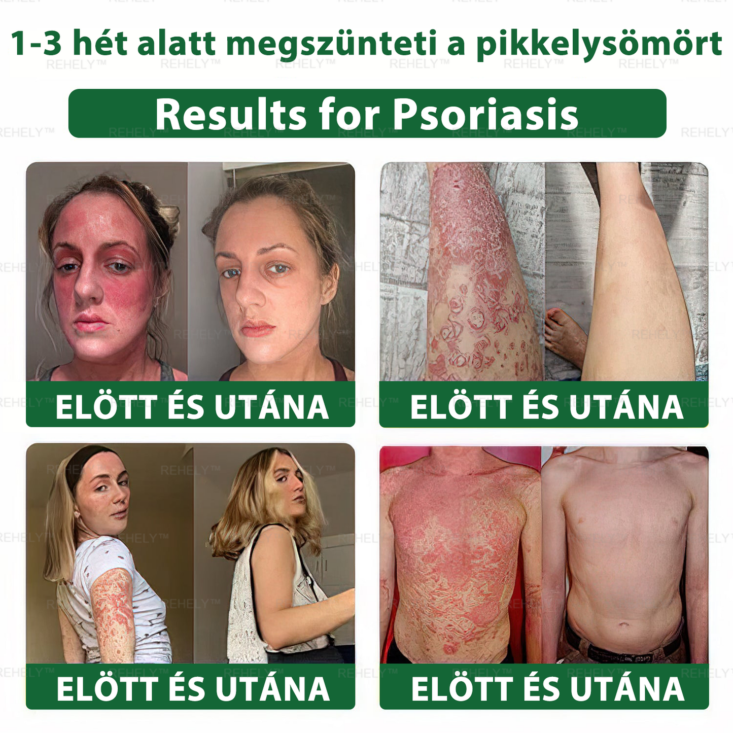 ☀️REHELY™ Természetes Bőrregeneráló Kenőcs | Tisztán vegán, állatkísérlet-mentes