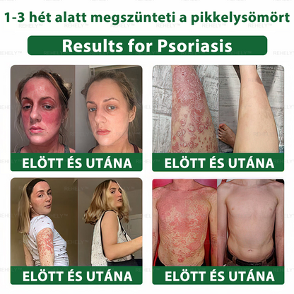 ☀️REHELY™ Természetes Bőrregeneráló Kenőcs | Tisztán vegán, állatkísérlet-mentes