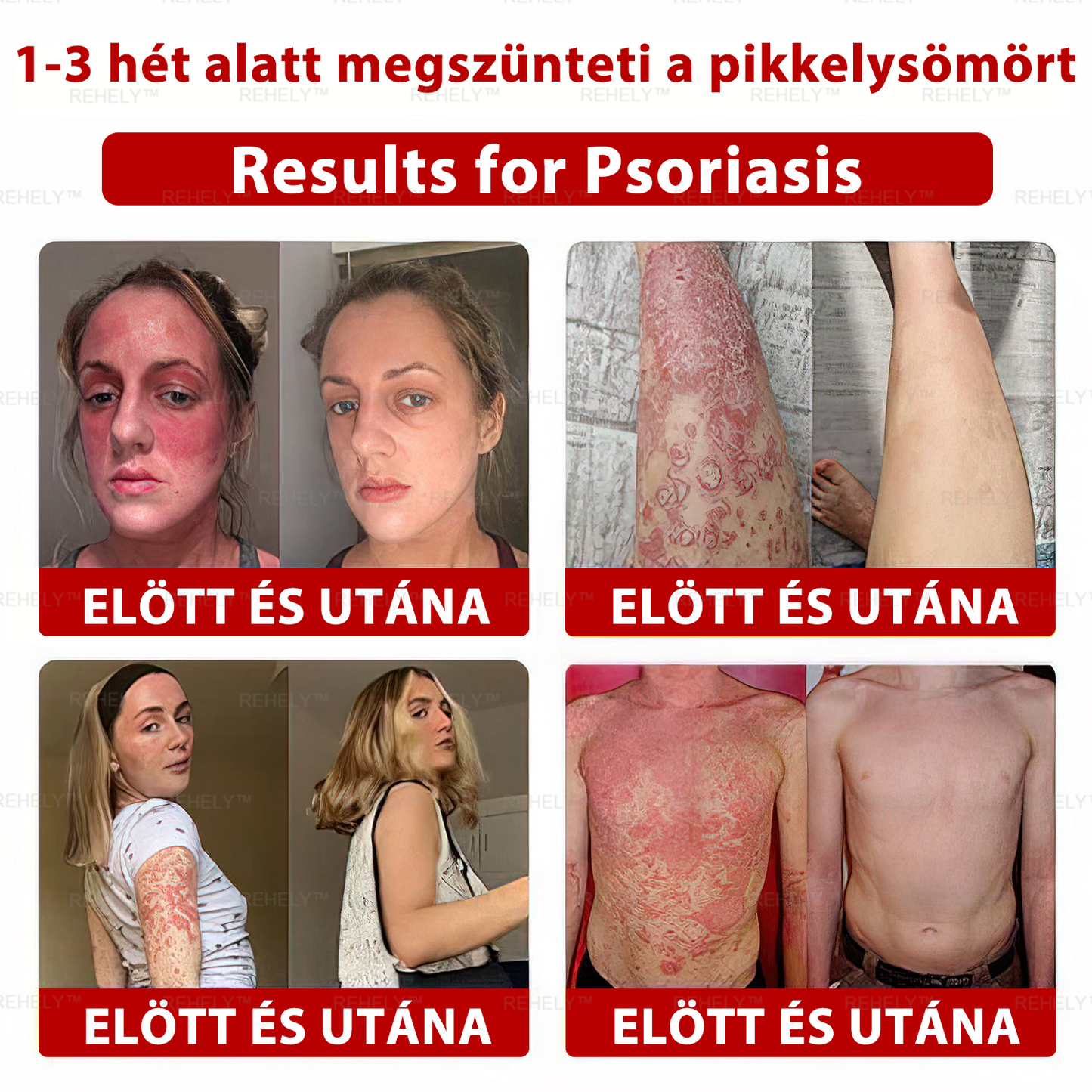 🌺REHELY™ Sejtregeneráló Hidratáló Krém