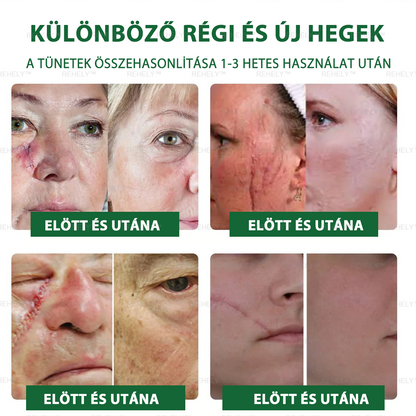 ☀️REHELY™ Természetes Bőrregeneráló Kenőcs | Tisztán vegán, állatkísérlet-mentes