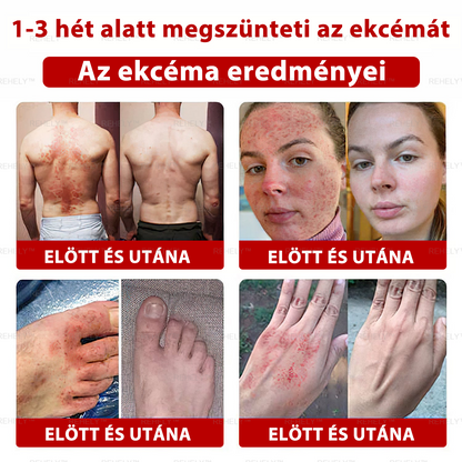 🌺REHELY™ Sejtregeneráló Hidratáló Krém