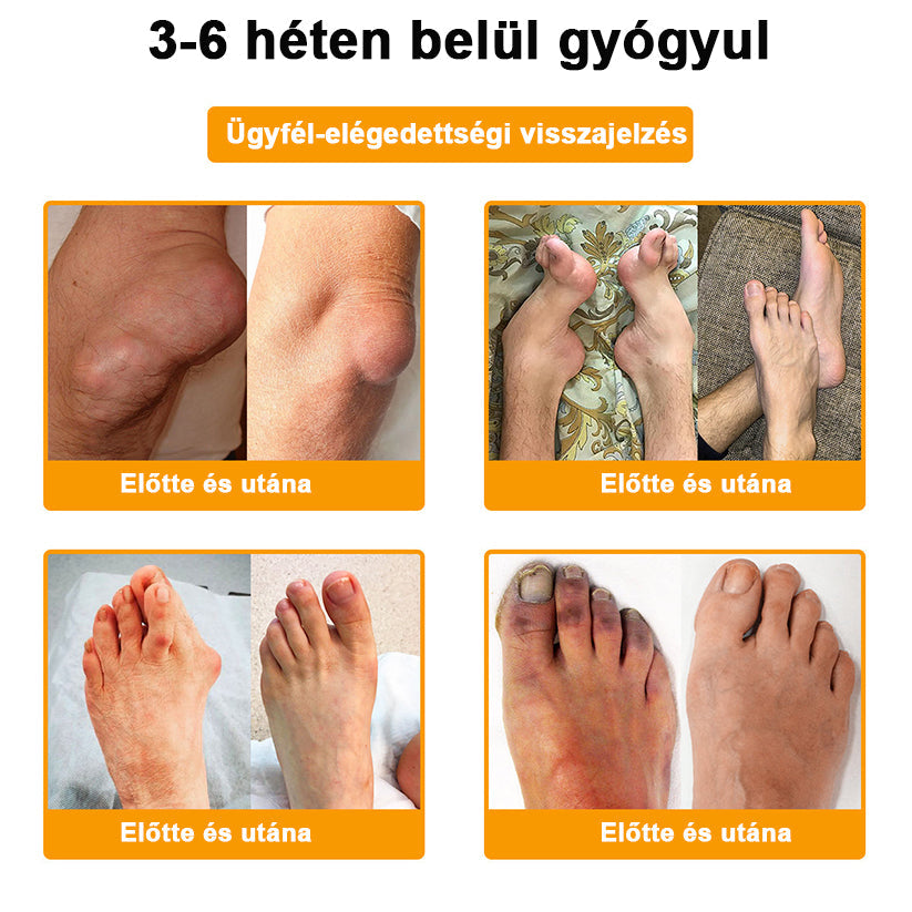 𝑺𝒕𝒂𝒘𝑽𝒊𝒕𝒂𝒍® Botoxot és Méhmérget Tartalmazó Regeneráló Krém Ízületekre és Csontokra | MOT (Magyar Ortopéd Társaság) által tanúsított termék