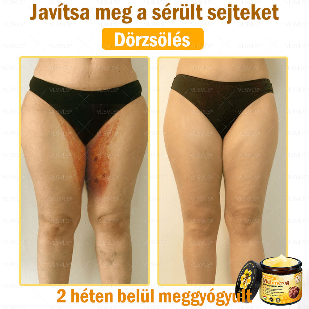 ✨✨✨💪VLSVLS® Méhméreg Bőrhelyreállító Krém (👨‍⚕‍CE jóváhagyott)👍✅