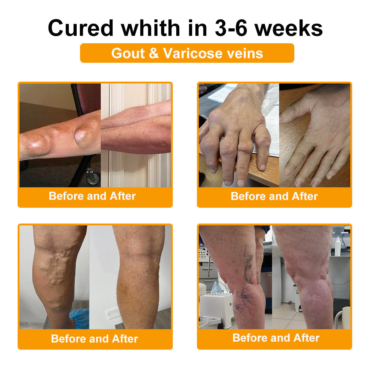 Gbpurity® Botulinum Toxin & Méhméreg Fájdalomcsillapító Krém 🍂 Hivatalos Márkabolt, MOT Jóváhagyással