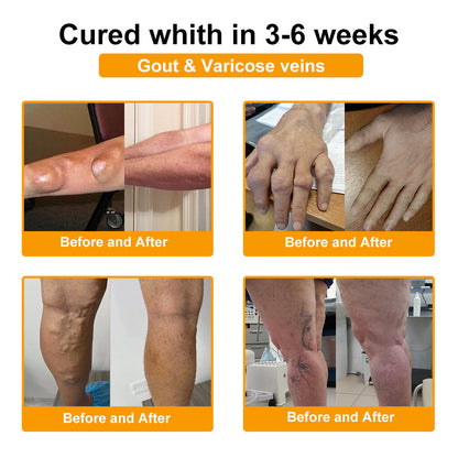 Gbpurity® Botulinum Toxin & Méhméreg Fájdalomcsillapító Krém 🍂 Hivatalos Márkabolt, MOT Jóváhagyással