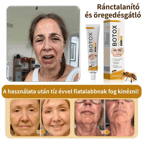 FrissArc™ Botox Méhméreg Ránctalanító Krém -✨Akció utolsó napja: 70% kedvezmény