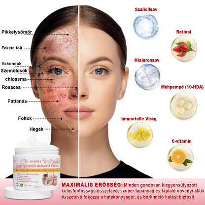 🌺REHELY™ Sejtregeneráló Hidratáló Krém