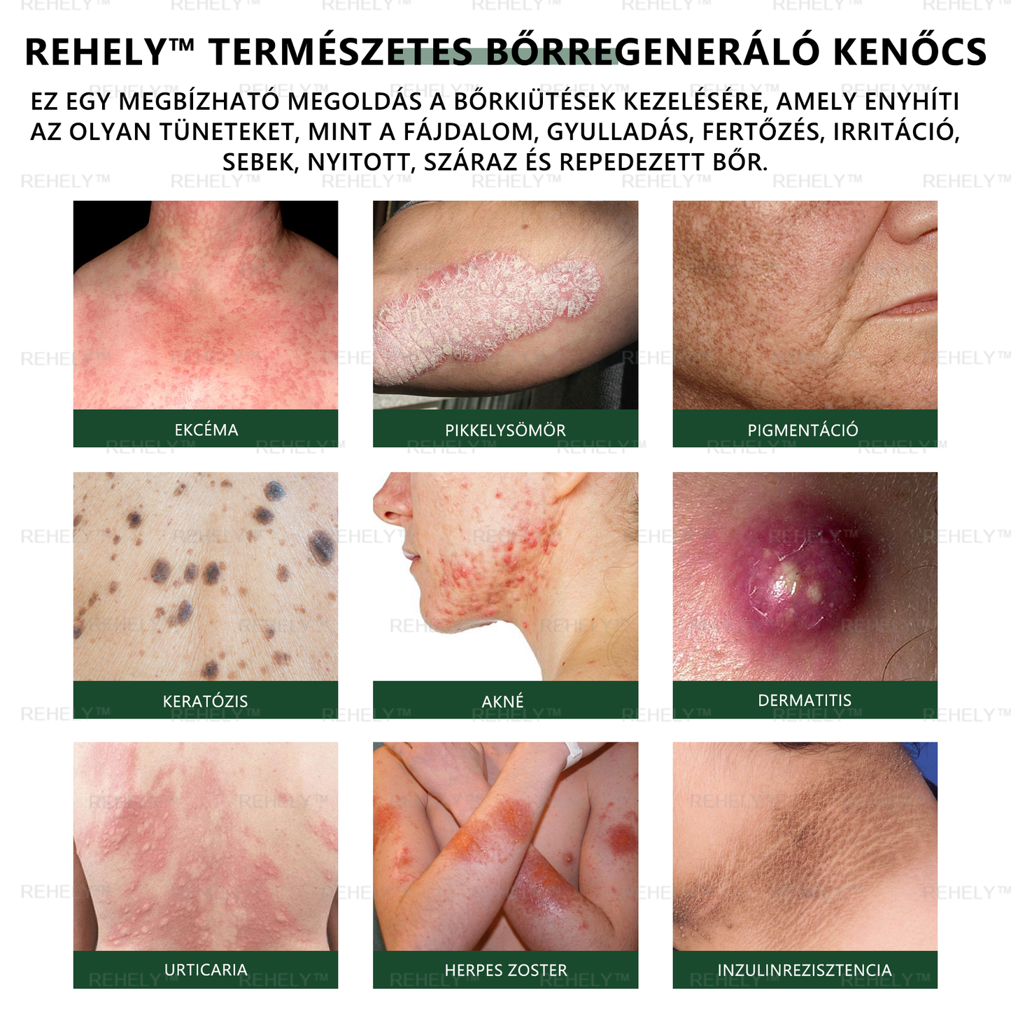 ☀️REHELY™ Természetes Bőrregeneráló Kenőcs | Tisztán vegán, állatkísérlet-mentes