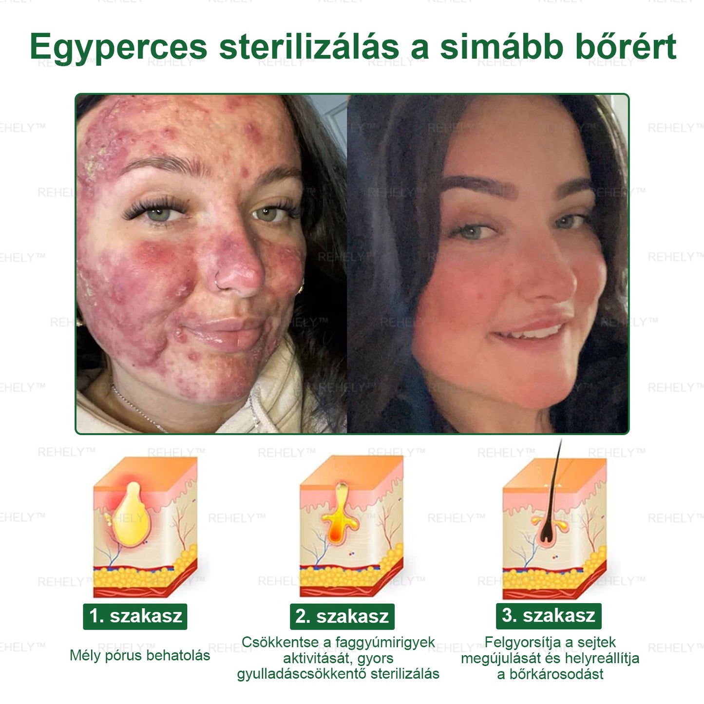 ☀️REHELY™ Természetes Bőrregeneráló Kenőcs | Tisztán vegán, állatkísérlet-mentes