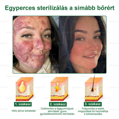 ☀️REHELY™ Természetes Bőrregeneráló Kenőcs | Tisztán vegán, állatkísérlet-mentes