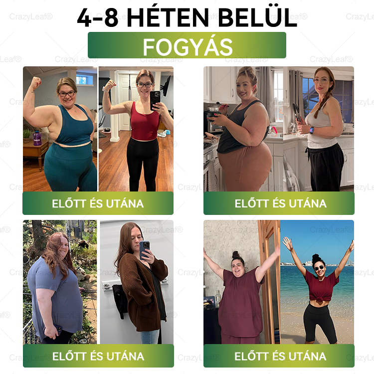 ✨✨│Hivatalos webáruház│🌿 CrazyLeaf® SMGT-GLP-1 Nano Mikrotűs Tapasz 👉Természetes segítség túlsúly, fáradtság, bőr- és ízületi problémák ellen.ermészetes segítség túlsúly, fáradtság, bőr- és ízületi problémák ellen.