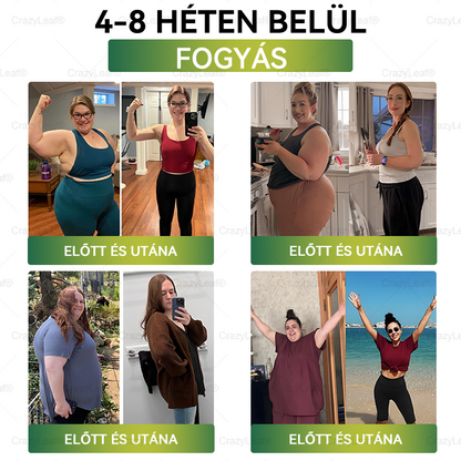 ✨✨│Hivatalos webáruház│🌿 CrazyLeaf® SMGT-GLP-1 Nano Mikrotűs Tapasz 👉Természetes segítség túlsúly, fáradtság, bőr- és ízületi problémák ellen.ermészetes segítség túlsúly, fáradtság, bőr- és ízületi problémák ellen.