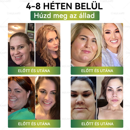 ✨✨│Hivatalos webáruház│🌿 CrazyLeaf® SMGT-GLP-1 Nano Mikrotűs Tapasz 👉Természetes segítség túlsúly, fáradtság, bőr- és ízületi problémák ellen.ermészetes segítség túlsúly, fáradtság, bőr- és ízületi problémák ellen.