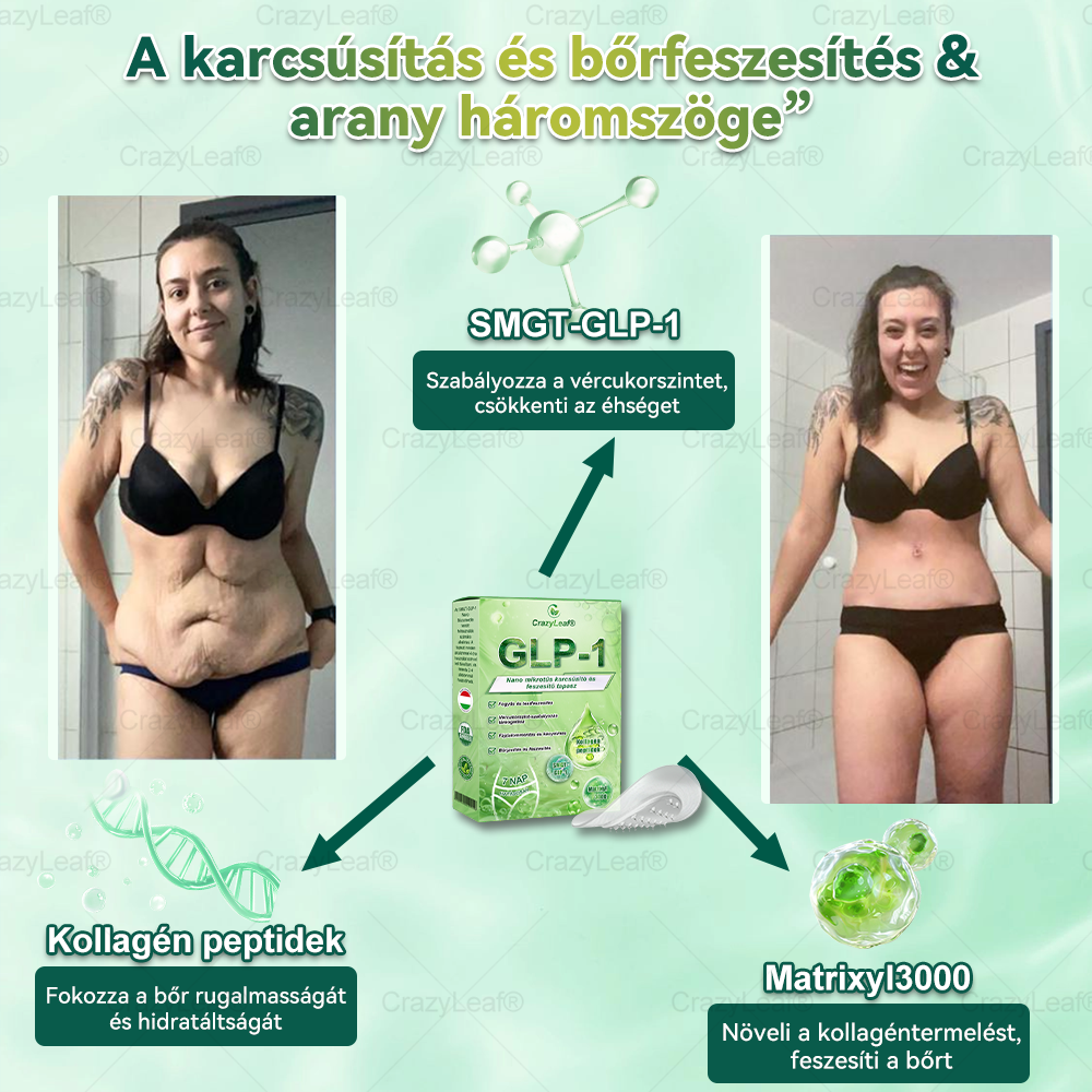✨✨│Hivatalos webáruház│🌿 CrazyLeaf® SMGT-GLP-1 Nano Mikrotűs Tapasz 👉Természetes segítség túlsúly, fáradtság, bőr- és ízületi problémák ellen.ermészetes segítség túlsúly, fáradtság, bőr- és ízületi problémák ellen.