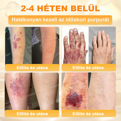 Dooeka® 𝟖-𝐈𝐧-𝟏 Méhméreg & Tallow Bőrfirmító és Regeneráló Krém ⭐ (7 napon belül hatékony) Méhméreg + Tallow · 7X Mélyhidratálás, célozza meg a ráncokat, megereszkedést, striákat, sötét foltokat, purpurát, gyulladásokat és még sok mást.