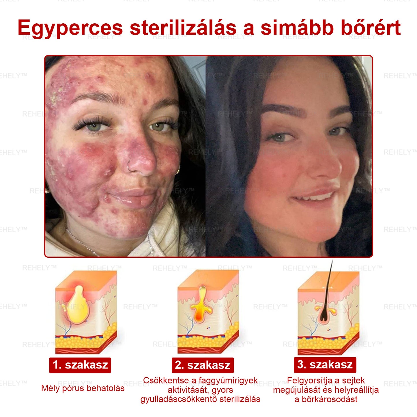 🌺REHELY™ Sejtregeneráló Hidratáló Krém