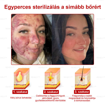 🌺REHELY™ Sejtregeneráló Hidratáló Krém