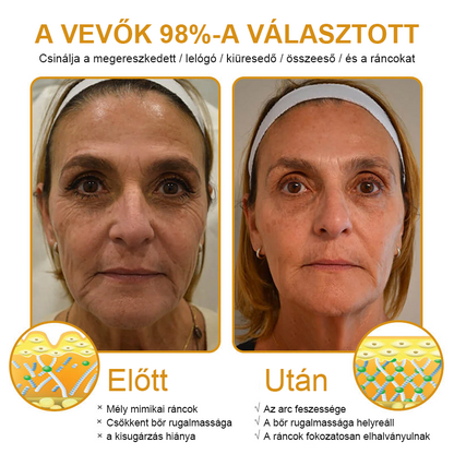 FrissArc™ Botox Méhméreg Ránctalanító Krém ☀️🌙 egész napos bőrápolás!