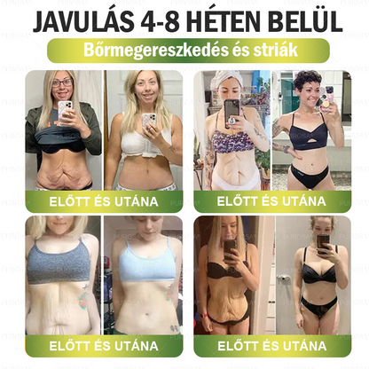 ✨✨│Hivatalos webáruház│🌿 CrazyLeaf® SMGT-GLP-1 Nano Mikrotűs Tapasz 👉Természetes segítség túlsúly, fáradtság, bőr- és ízületi problémák ellen.ermészetes segítség túlsúly, fáradtság, bőr- és ízületi problémák ellen.