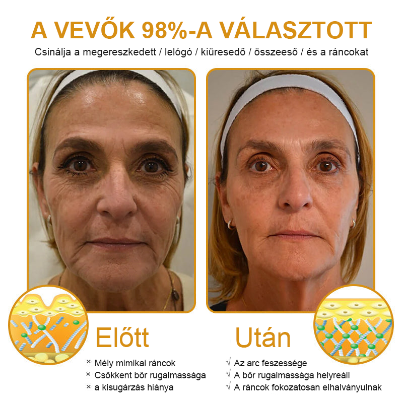 FrissArc™ Botox Méhméreg Ránctalanító Krém -✨Akció utolsó napja: 70% kedvezmény