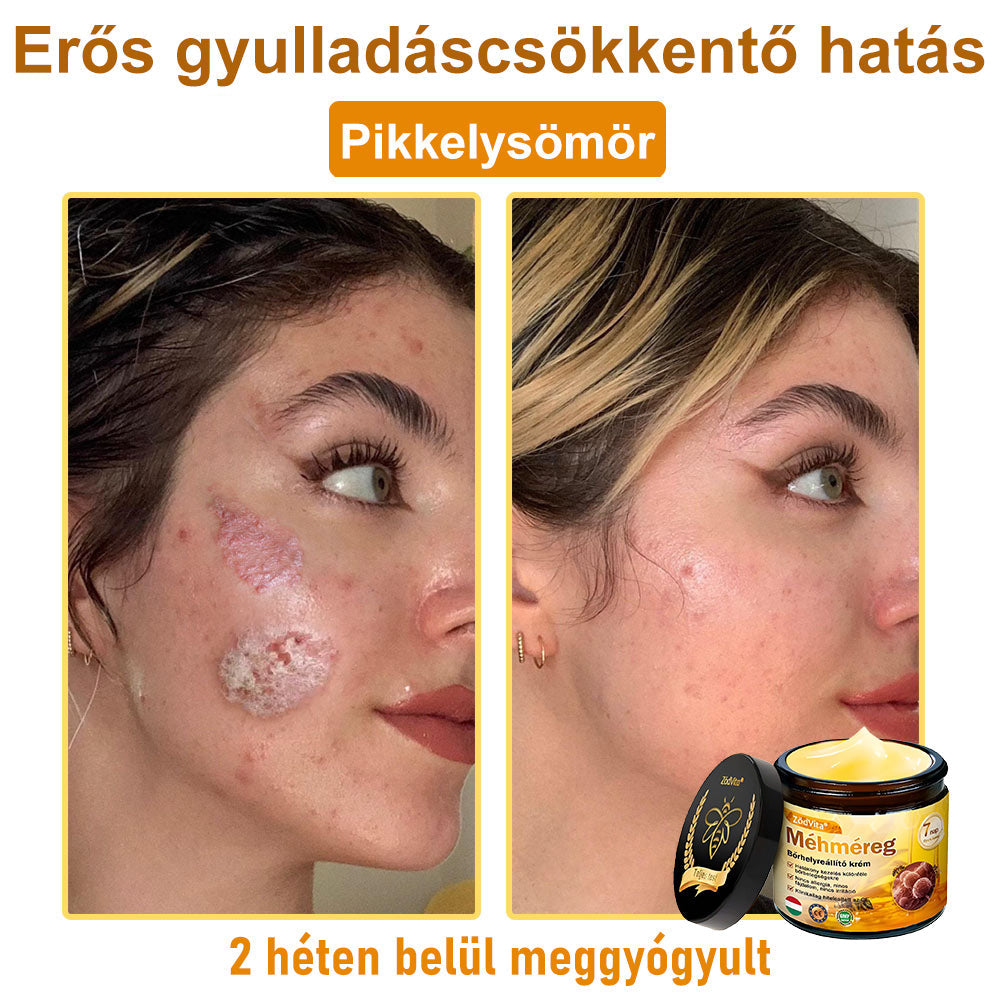 🐝🐝 ZödVita® Méhméreg Bőr Helyreállító Krém (👨‍⚕‍CE jóváhagyott)👍✅