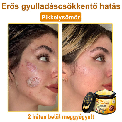 🐝🐝 ZödVita® Méhméreg Bőr Helyreállító Krém (👨‍⚕‍CE jóváhagyott)👍✅