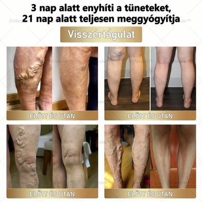 🎅🎁 Gratulálunk! Ön lett a mai szerencsés vásárló, és most egy extra 50%-os kedvezményt biztosítunk Önnek! Ne hagyja ki ezt a fantasztikus lehetőséget – ha most lemarad, csak jövő karácsonykor lesz újra ilyen ajánlat! 🌟