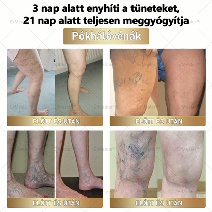 🎅🎁 Gratulálunk! Ön lett a mai szerencsés vásárló, és most egy extra 50%-os kedvezményt biztosítunk Önnek! Ne hagyja ki ezt a fantasztikus lehetőséget – ha most lemarad, csak jövő karácsonykor lesz újra ilyen ajánlat! 🌟