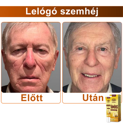 ✨💛✨SzemFény™ Kollagén+ Méhméreg Ébresztő Szemkrém - CE minősítést szerzett - Minden bőrtípusra alkalmazható