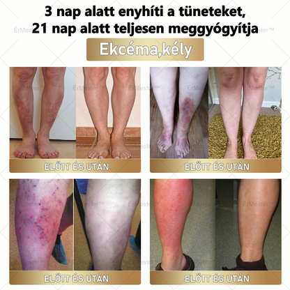 🎅🎁 Gratulálunk! Ön lett a mai szerencsés vásárló, és most egy extra 50%-os kedvezményt biztosítunk Önnek! Ne hagyja ki ezt a fantasztikus lehetőséget – ha most lemarad, csak jövő karácsonykor lesz újra ilyen ajánlat! 🌟