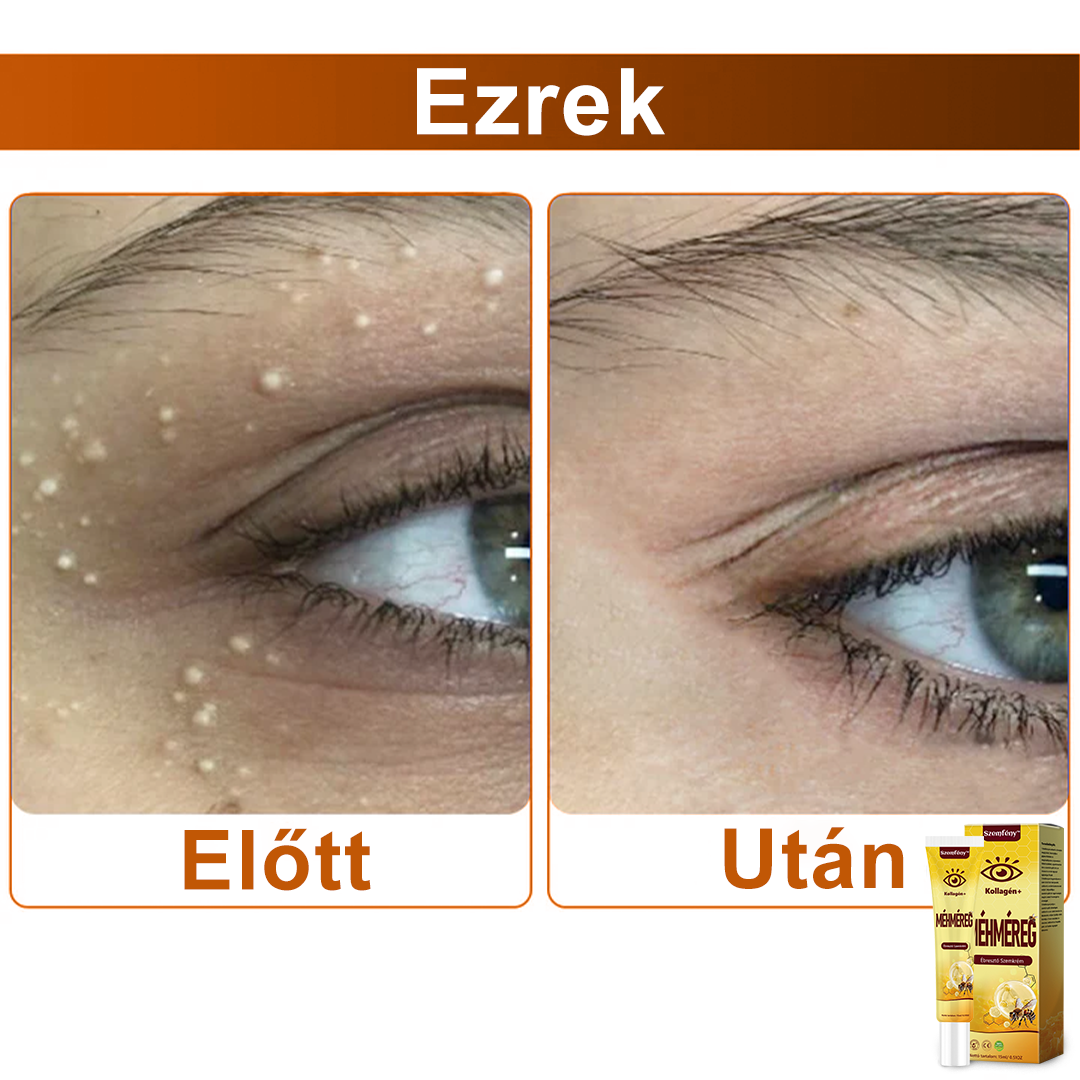 💛SzemFény™ Kollagén+ Méhméreg Ébresztő Szemkrém - Bőrgyógyász Által Ajánlott - CE minősítést szerzett