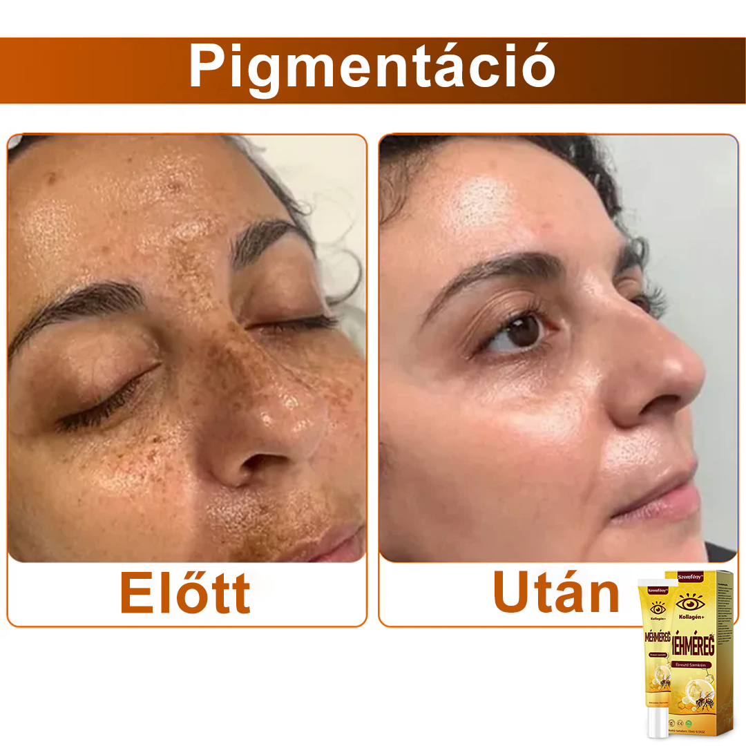 ✨💛✨SzemFény™ Kollagén+ Méhméreg Ébresztő Szemkrém - CE minősítést szerzett - Minden bőrtípusra alkalmazható