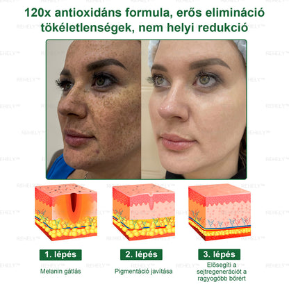 ☀️REHELY™ Természetes Bőrregeneráló Kenőcs | Tisztán vegán, állatkísérlet-mentes