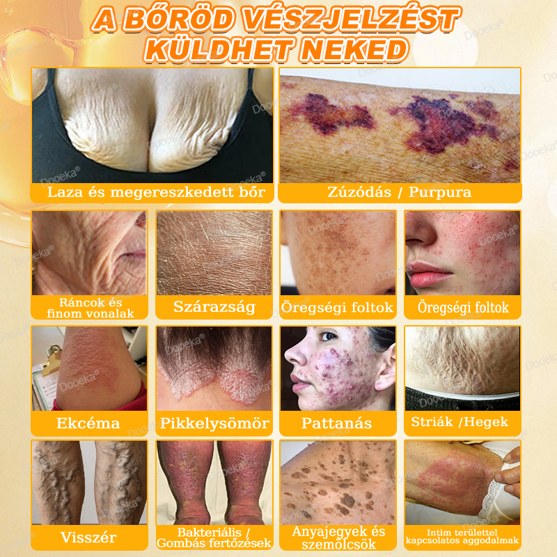 Dooeka® 𝟖-𝐈𝐧-𝟏 Méhméreg & Tallow Bőrfirmító és Regeneráló Krém ⭐ (7 napon belül hatékony) Méhméreg + Tallow · 7X Mélyhidratálás, célozza meg a ráncokat, megereszkedést, striákat, sötét foltokat, purpurát, gyulladásokat és még sok mást.
