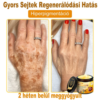 🐝🐝 ZödVita® Méhméreg Bőr Helyreállító Krém (👨‍⚕‍CE jóváhagyott)👍✅