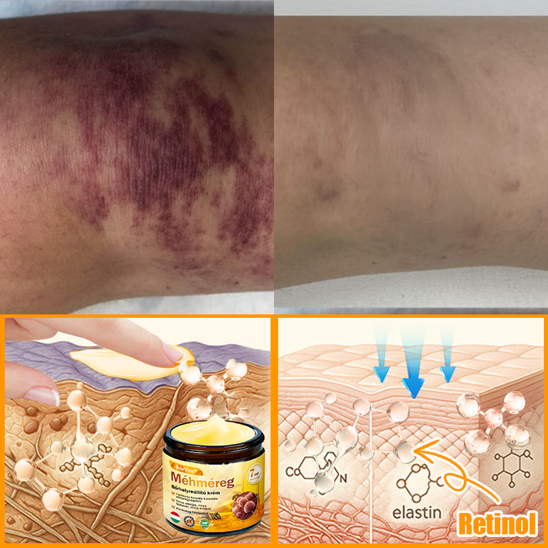 🐝🐝 ZödVita® Méhméreg Bőr Helyreállító Krém (👨‍⚕‍CE jóváhagyott)👍✅