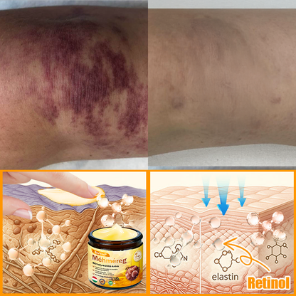 🐝🐝 ZödVita® Méhméreg Bőr Helyreállító Krém (👨‍⚕‍CE jóváhagyott)👍✅