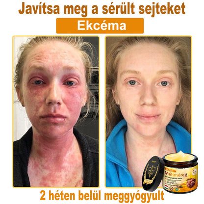 🐝🐝 ZödVita® Méhméreg Bőr Helyreállító Krém (👨‍⚕‍CE jóváhagyott)👍✅